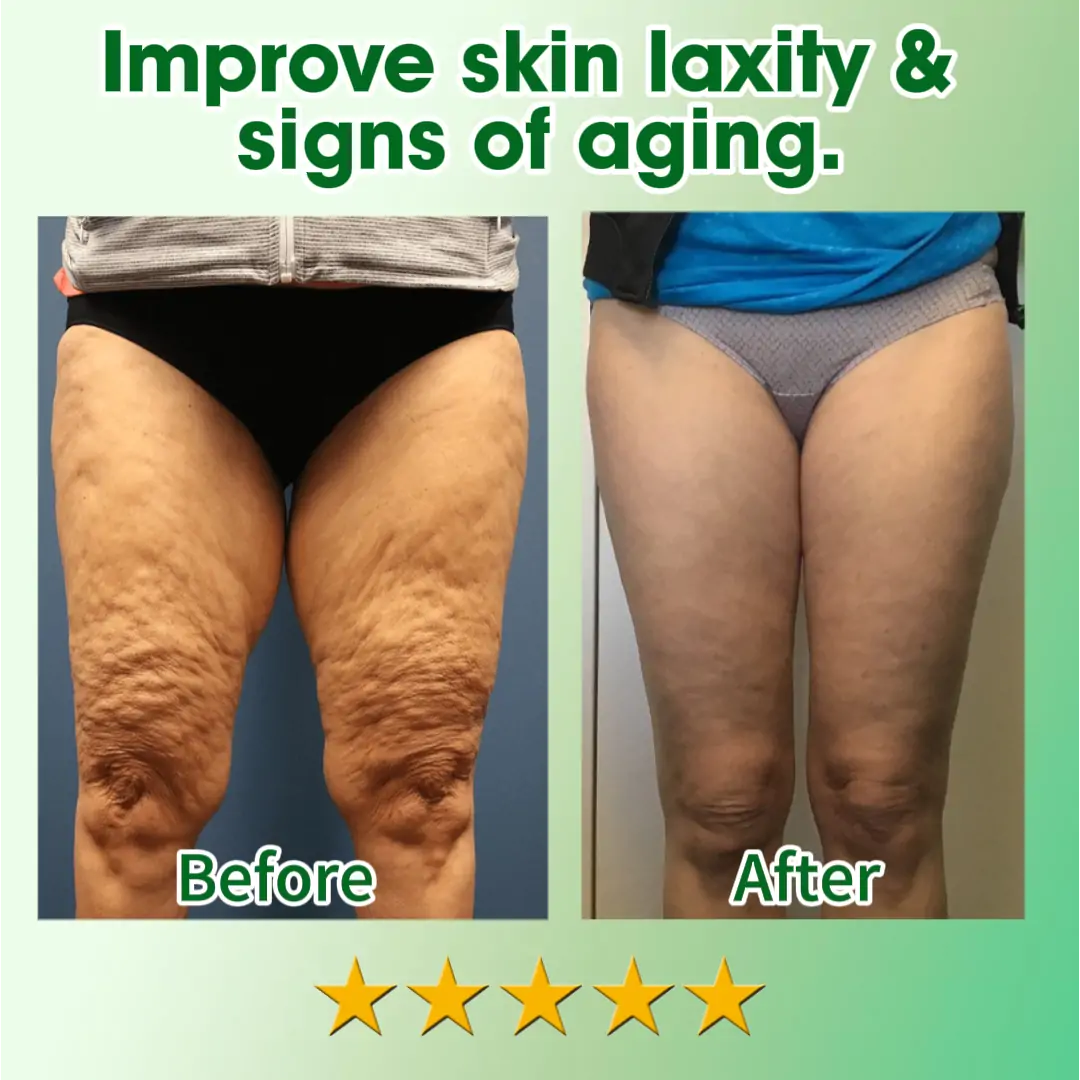 JEREMYTIS™ 30 Herbal Firming Slimming & Detox Foot Bath Beads 🌿