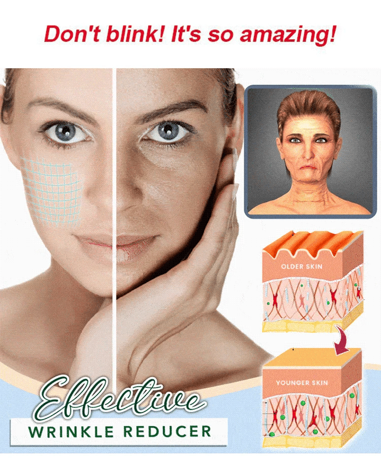 🎉Hot Sale 49% OFF🎉 Temporary Face Tightener