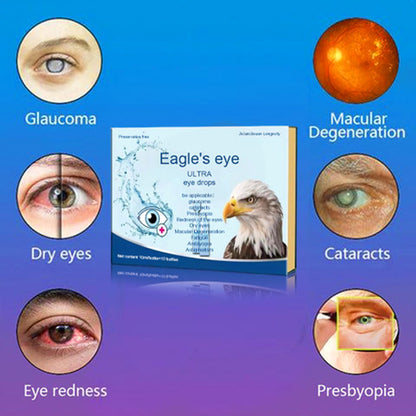 Eagle's Cataracts Glaucoma Lubricating Eye Drops