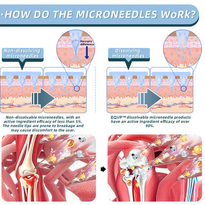 ✅Official Store：👩‍⚕️Recommended by AAOS🦾ODALIT™ Nano-microneedle joint patch
