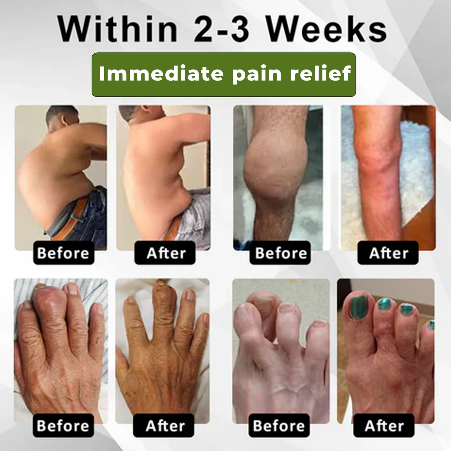 🔥ODALIT™ SNAKE PEPTIDE 3X Instant Joint Pain Relief Gel 🐍💎