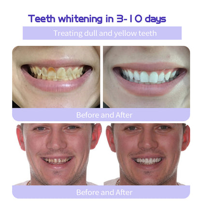 NEGUSY™ Teeth Restoration Mineral Powder🦷(TGA recommended)(🎁Flash Sale - Don’t Miss Out)