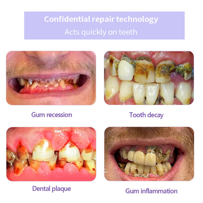 NEGUSY™ Teeth Restoration Mineral Powder🦷(TGA recommended)(🎁Flash Sale - Don’t Miss Out)