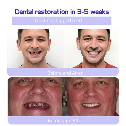 ODALIT™ Teeth Restoration Mineral Powder🦷(🎁Flash Sale - Don’t Miss Out)