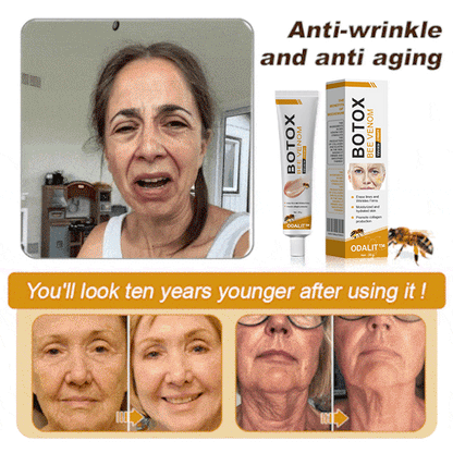 🔥Flash Sale - ODALIT™ Botox Bee Venom Wrinkle Removal Cream🐝
