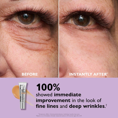 💥Last Day 49% OFF 🪄No-Filter Eye Tightener