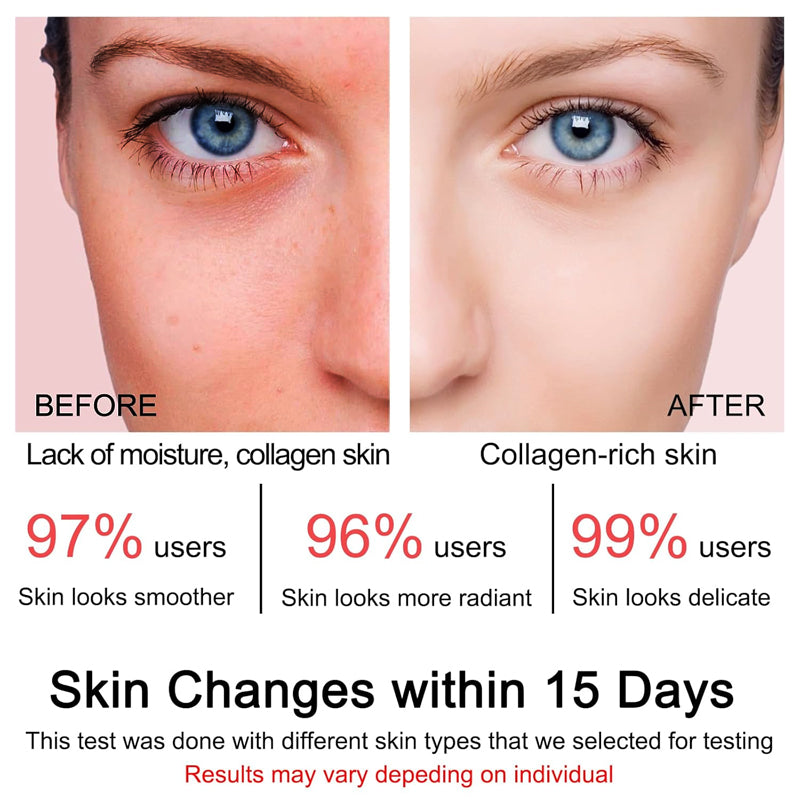 NEGUSY™ Collagen Jelly Cream
