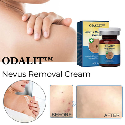 ✅Official Store:ODALIT™ Nevus Removal Cream