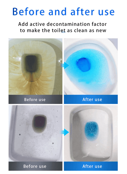 🔥 48% OFF💕SINK & DRAIN CLEANER🔥Buy2 Get 1 Free