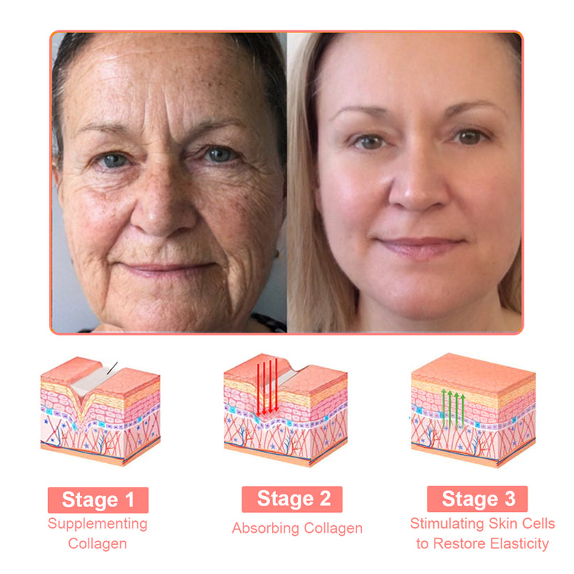 NEGUSY™ Collagen Jelly Cream