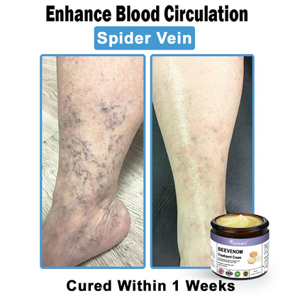 Ourlyard® Bee Venom Skin Treatment Cream👨‍⚕️Treats warts, growths, infections, and scars, smooths uneven skin, and is certified by the British Association of Dermatologists (BAD)