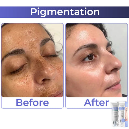 JEREMYTIS™ Advanced Collagen Complete Eye Cream