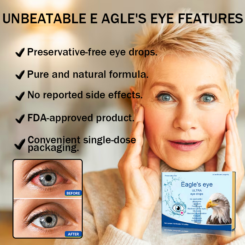 Eagle's Cataracts Glaucoma Lubricating Eye Drops