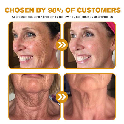 🔥Flash Sale - ODALIT™ Botox Bee Venom Wrinkle Removal Cream🐝