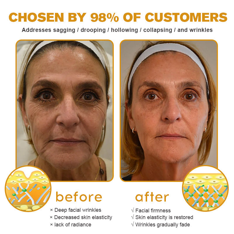 🔥Flash Sale - ODALIT™ Botox Bee Venom Wrinkle Removal Cream🐝