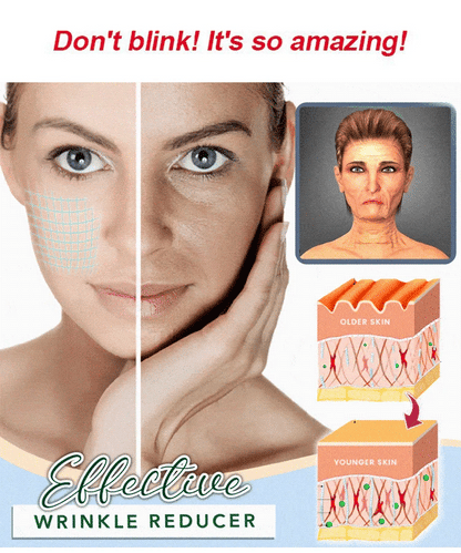 🎉Hot Sale 49% OFF🎉 Temporary Face Tightener